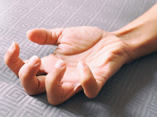 Căn bệnh co giật trông như thế nào? 1 benh-co-giat