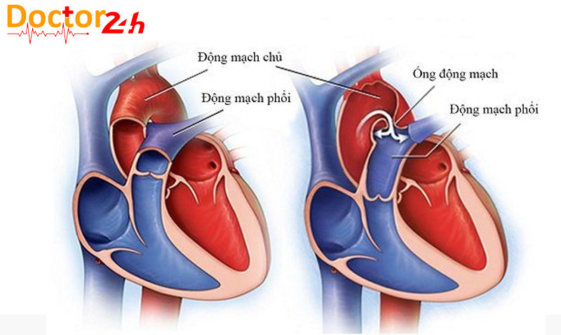 Tim hoạt động như thế nào và bơm máu qua cơ thể con người ra sao? 4 chu-trinh-bom-mau-cua-tim