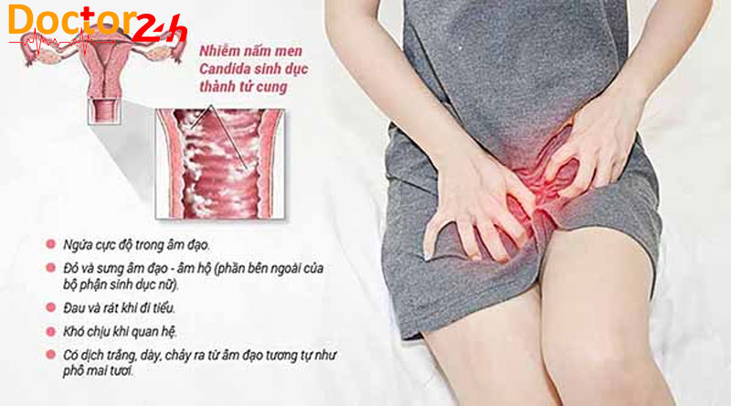Bệnh nấm Candida và cách điều trị tối ưu nhất 2 nam-Candida