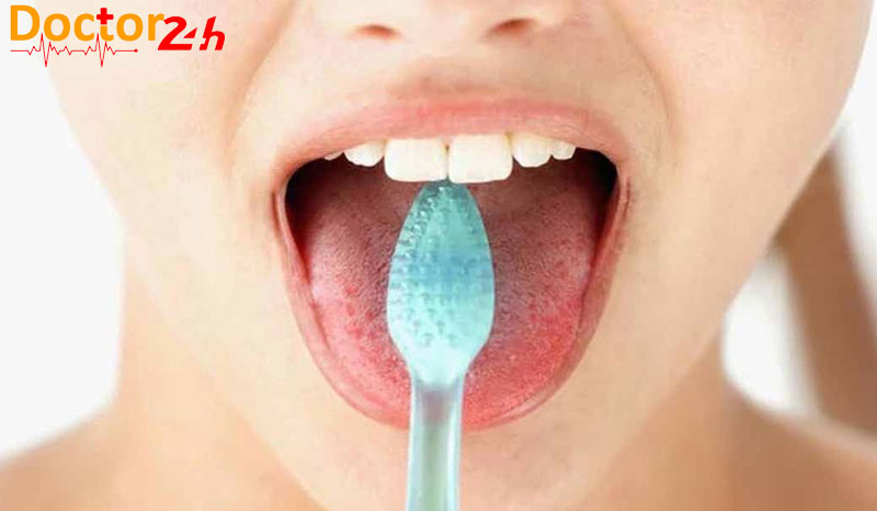 Khái niệm cơ bản về nứt lưỡi, nguyên nhân và cách điều trị 3 ve-sinh-mieng