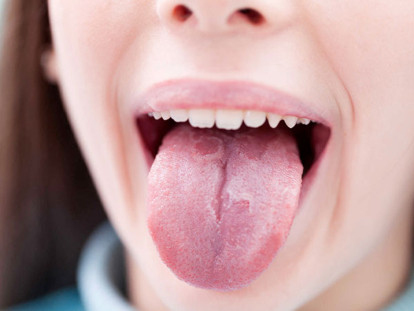 Bệnh bạch sản niêm mạc miệng điều trị thế nào? 1 benh-bach-san