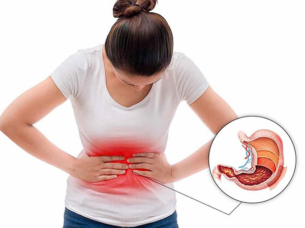 Bệnh Loét Tiêu Hóa 1 benh-viem-loet-tieu-hoa