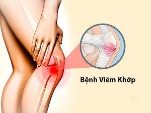 benh-viem-khop