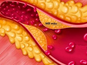 cholesterol-mau-gia-dinh