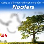 dom-den trong tam nhin