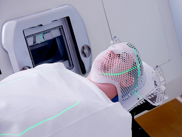 hoa-tri-ung-thu-vom-hong