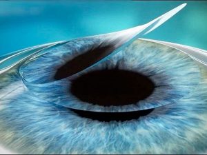 nhung-buoc-chuan-bi-cat-got-giac-mac