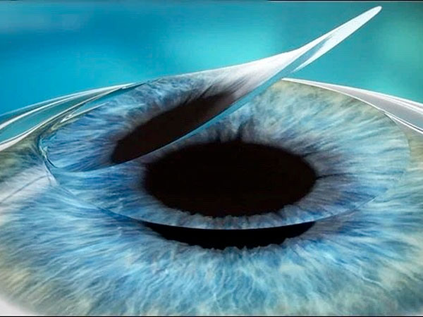 nhung-buoc-chuan-bi-cat-got-giac-mac