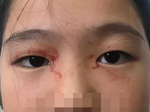 bé-gai-11-tuoi-ra-mo-hoi-do