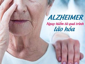benh-alzheimer