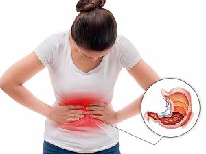 benh-viem-loet-tieu-hoa