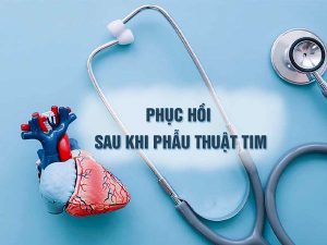 phuc-hoi-sau-khi-phau-thuat-tim