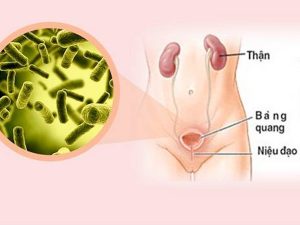 benh-lao-duong-tiet-nieu-sinh-duc