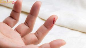 cach-cam-mau-cho-nguoi-mau-kho-dong